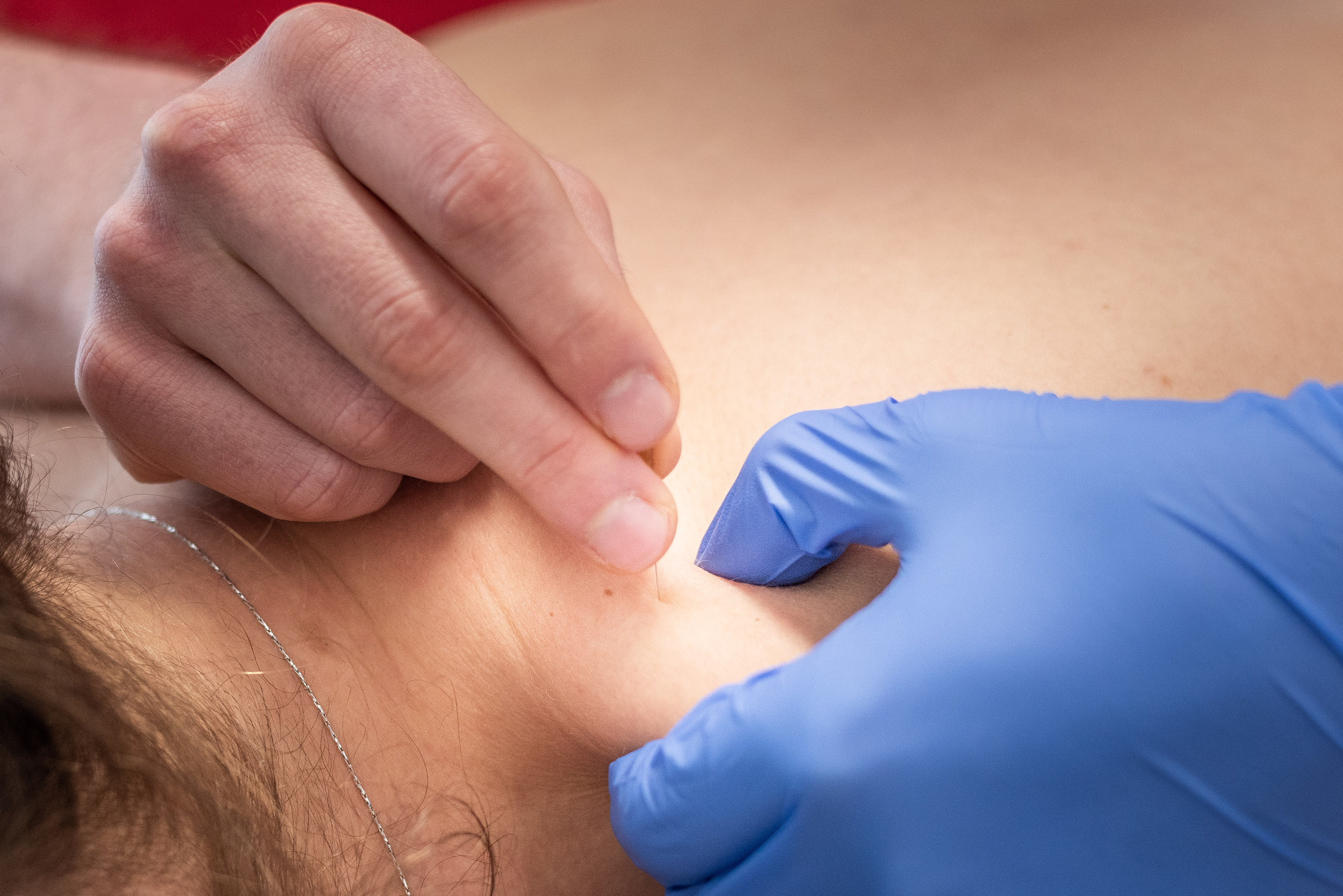 Trigger point therapy / Dry needling PHYSIOZENTRUM